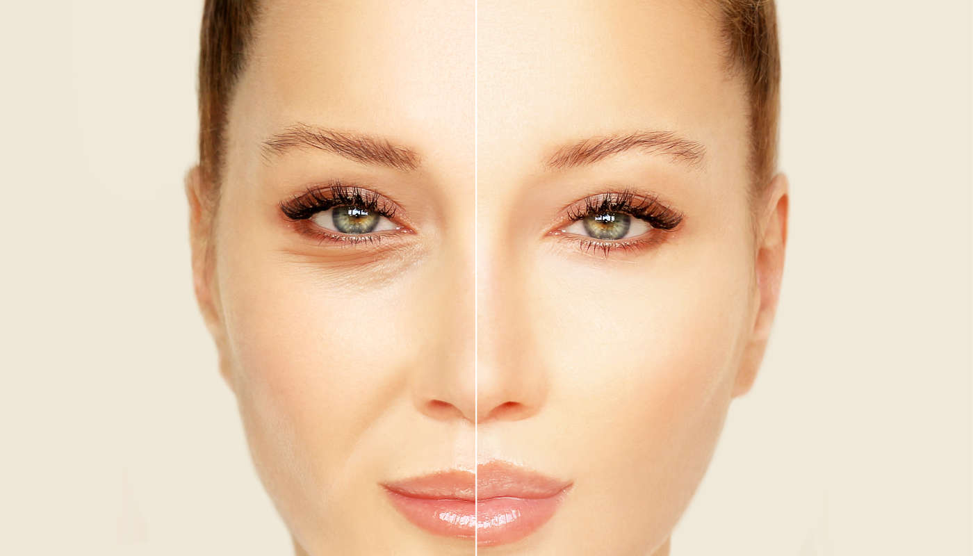 Come cambia la nostra pelle dopo i quaranta anni - Foto: stock.adobe.com